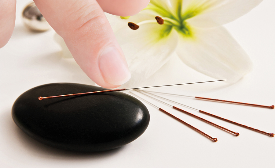 Akupunktur in Hilden
